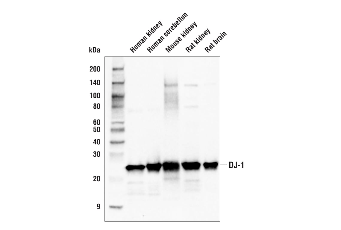 Western Blotting Image 2: DJ-1 (E9T6J) Mouse Monoclonal Antibody