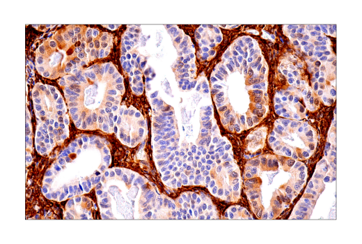 undefined Image 26: Ferroptosis Antibody Sampler Kit