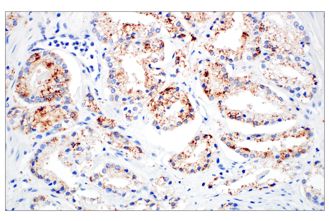 Immunohistochemistry Image 10: Perilipin-2 (E6G6M) Rabbit Monoclonal Antibody