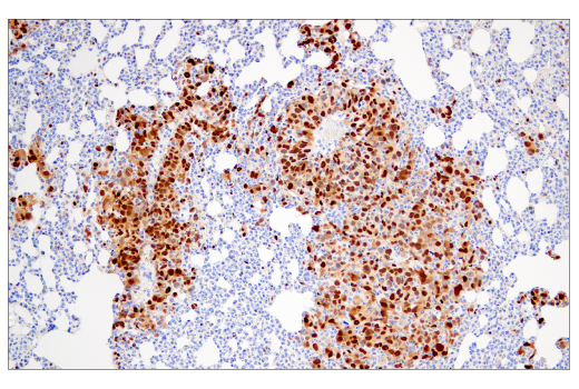 Immunohistochemistry Image 4: Cyclin D1 (E3P5S) Rabbit Monoclonal Antibody (BSA and Azide Free)