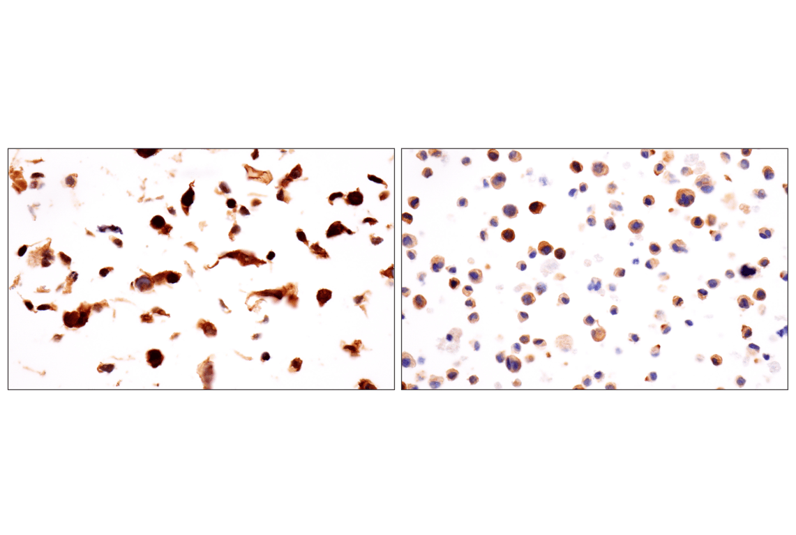 Immunohistochemistry Image 10: Cyclin B1 (F7U1O) Rabbit Monoclonal Antibody