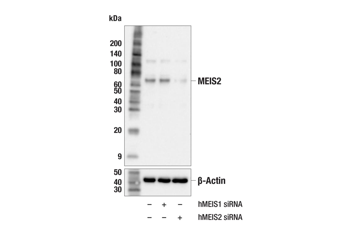 Western Blotting Image 2: MEIS2 (F9I5S) Rabbit Monoclonal Antibody