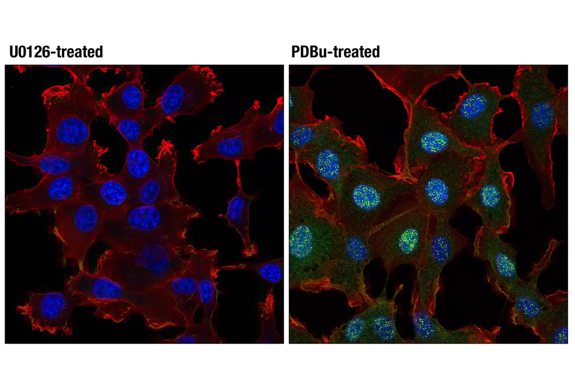 Immunofluorescence Image 1: Phospho-p44/42 MAPK (Erk1/2) (Thr202/Tyr204) (197G2) Rabbit Monoclonal Antibody (BSA and Azide Free)