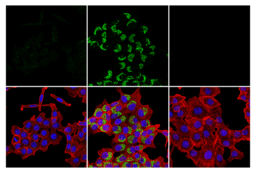 Immunofluorescence Image 1: LC3B (D11) Rabbit Monoclonal Antibody (BSA and Azide Free)