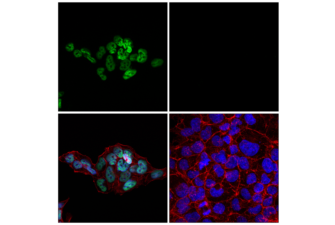 Immunofluorescence Image 1: TCF4/ITF2 (E3X2Y) Rabbit Monoclonal Antibody