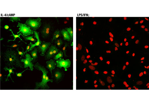 Immunofluorescence Image 1: Arginase-1 (D4E3M<sup>™</sup>) XP<sup>®</sup> Rabbit mAb