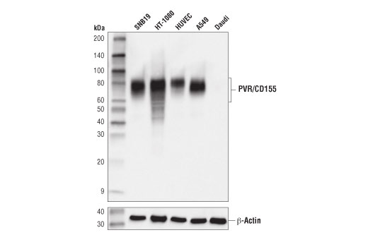 Western Blotting Image 1: PVR/CD155 (D8A5G) Rabbit mAb