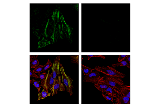 Immunofluorescence Image 1: Phospho-Myosin Light Chain 2 (Thr18/Ser19) (E2J8F) Rabbit Monoclonal Antibody