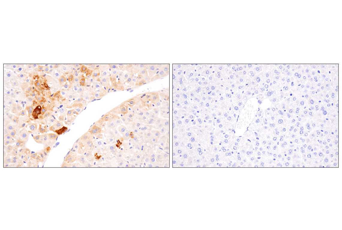 Immunohistochemistry Image 7: APOBEC3A (UMN-13) Rabbit Monoclonal Antibody (BSA and Azide Free)