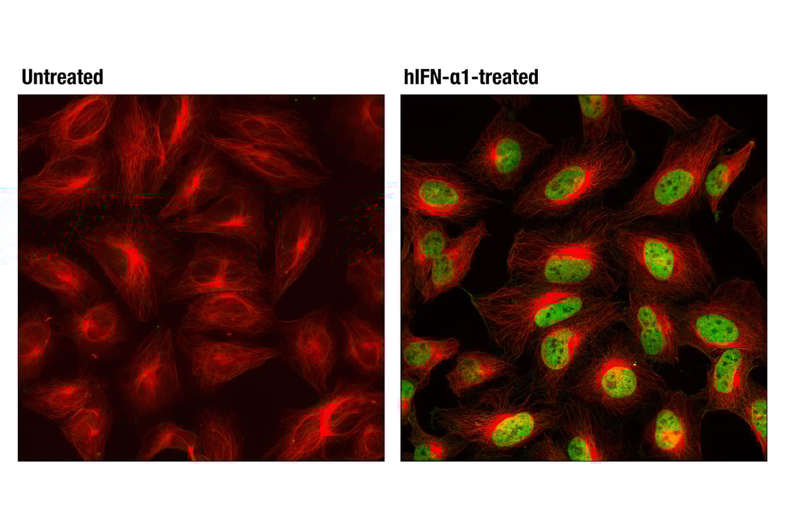 undefined Image 9: Phospho-Stat Antibody Sampler Kit
