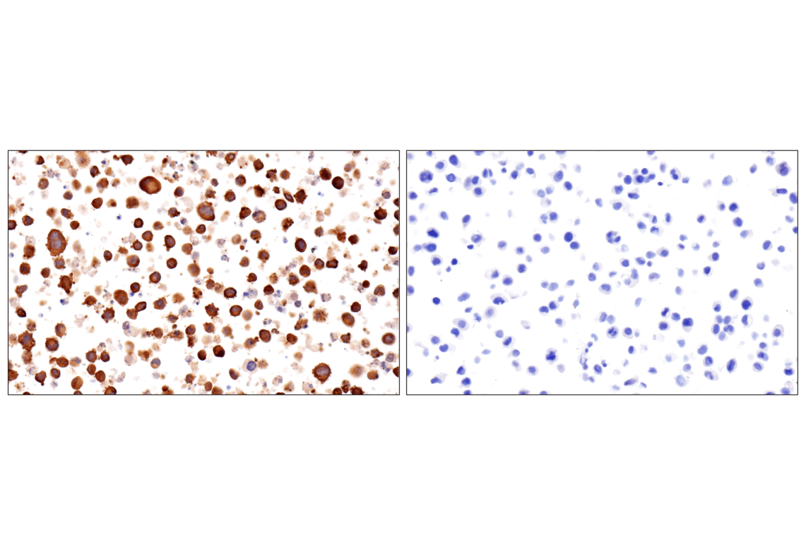 Immunohistochemistry Image 22: PPP1R14A/CPI-17 (F1I6X) Rabbit Monoclonal Antibody