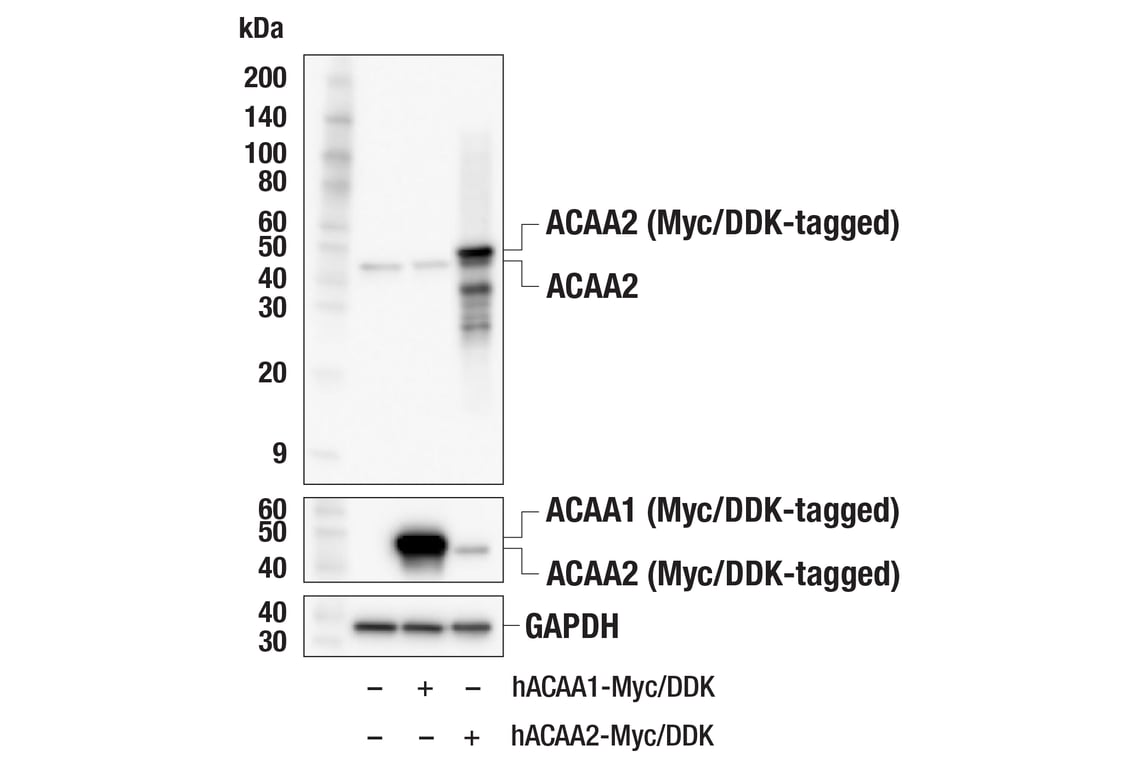 Western Blotting Image 3: ACAA2 (F4Y9U) Rabbit Monoclonal Antibody