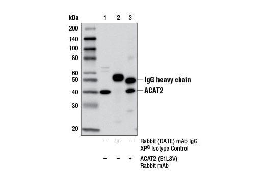 Immunoprecipitation Image 1: ACAT2 (E1L8V) Rabbit Monoclonal Antibody
