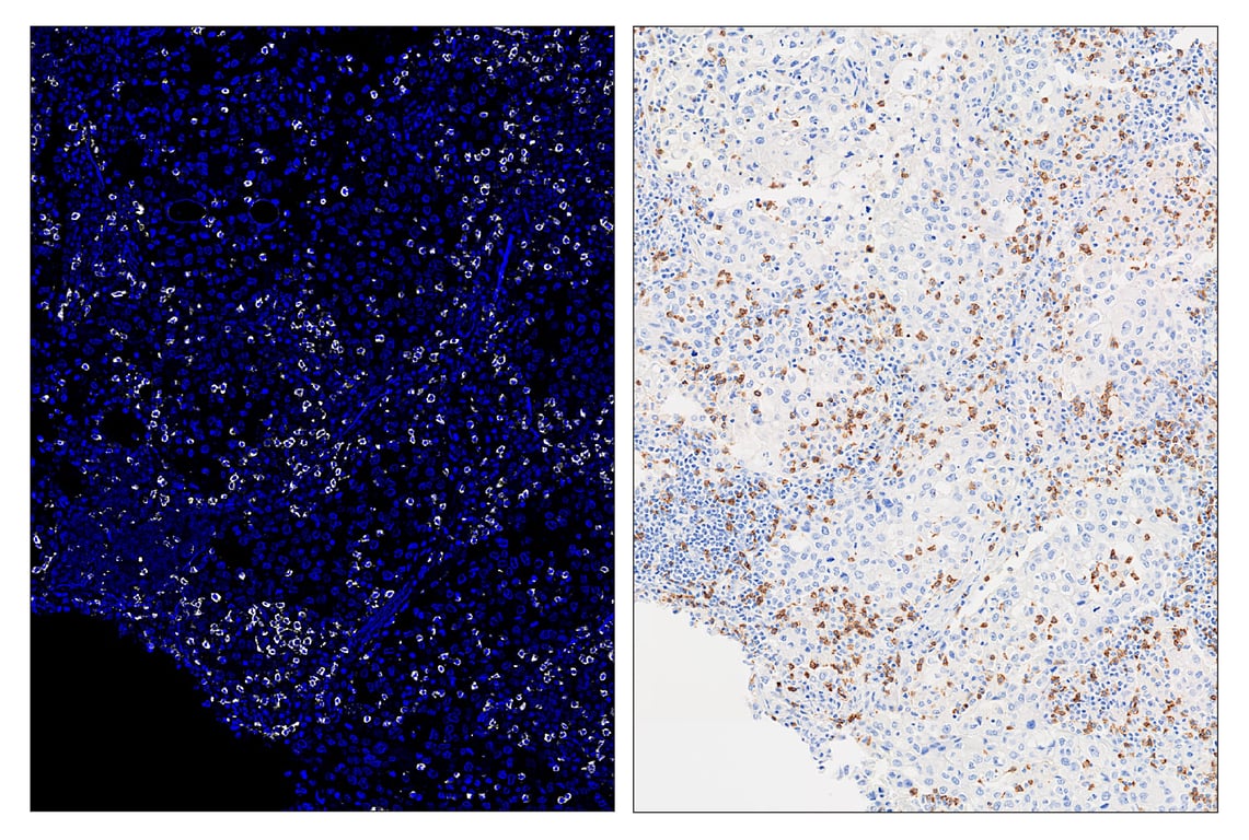 Immunohistochemistry Image 6: CD8 alpha (D8A8Y) & CO-0004-594 SignalStar<sup>™</sup> Oligo-Antibody Pair
