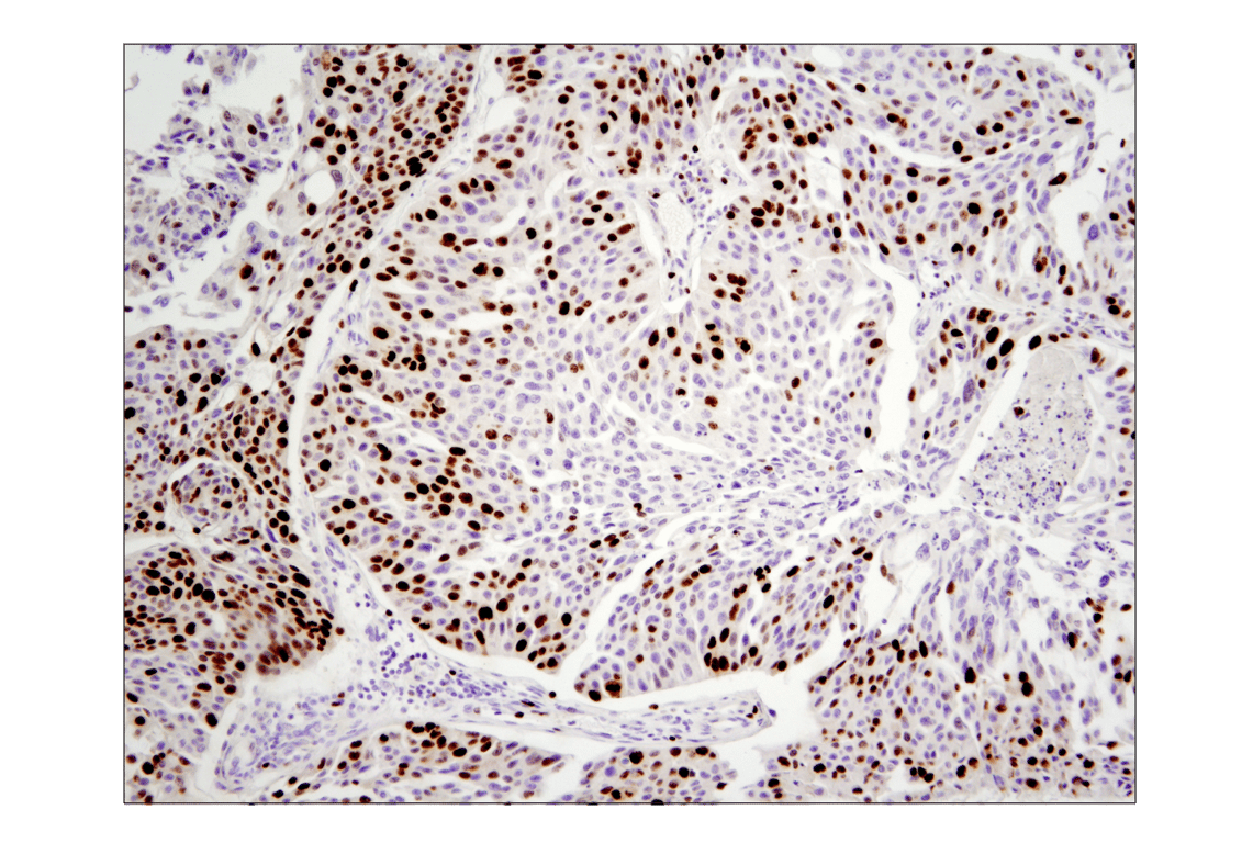 Immunohistochemistry Image 3: Ki-67 (D2H10) Rabbit Monoclonal Antibody (BSA and Azide Free)