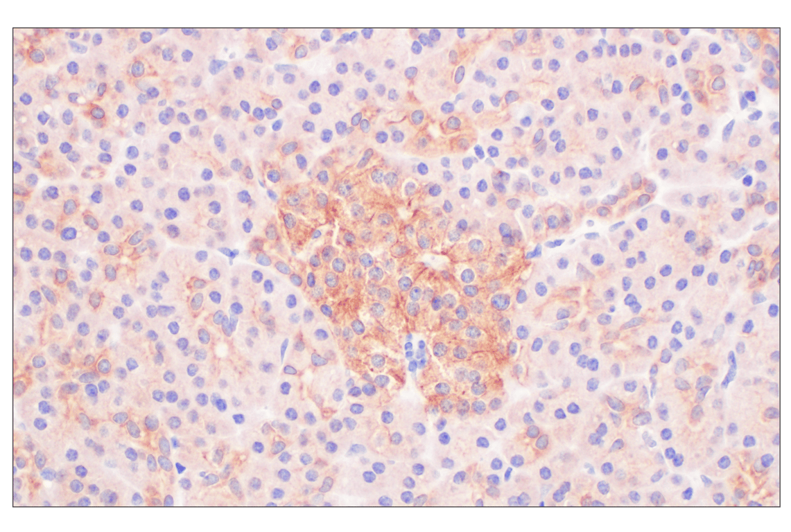 Immunohistochemistry Image 5: Desmoplakin (F3J8Y) Rabbit Monoclonal Antibody