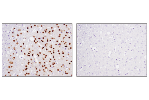 Immunohistochemistry Image 2: TBR1 (D6C6X) Rabbit Monoclonal Antibody (BSA and Azide Free)