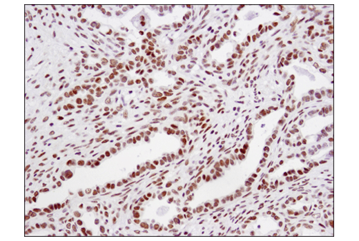 Immunohistochemistry Image 4: TRIM33 (D7U4F) Rabbit Monoclonal Antibody