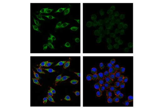 Immunofluorescence Image 1: IkappaB beta (D1T3Z) Rabbit Monoclonal Antibody