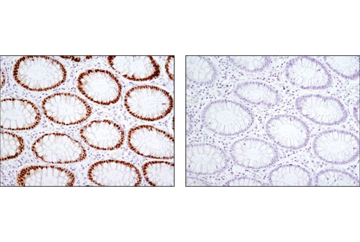 Immunohistochemistry Image 1: CDX2 (D11D10) Rabbit Monoclonal Antibody (BSA and Azide Free)