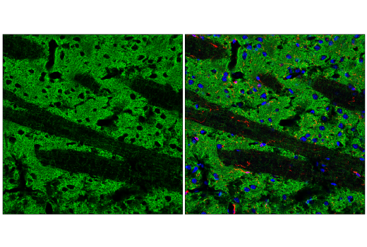 undefined Image 5: Genetics of Parkinson's Disease: Lysosomal Dysfunction Antibody Sampler Kit