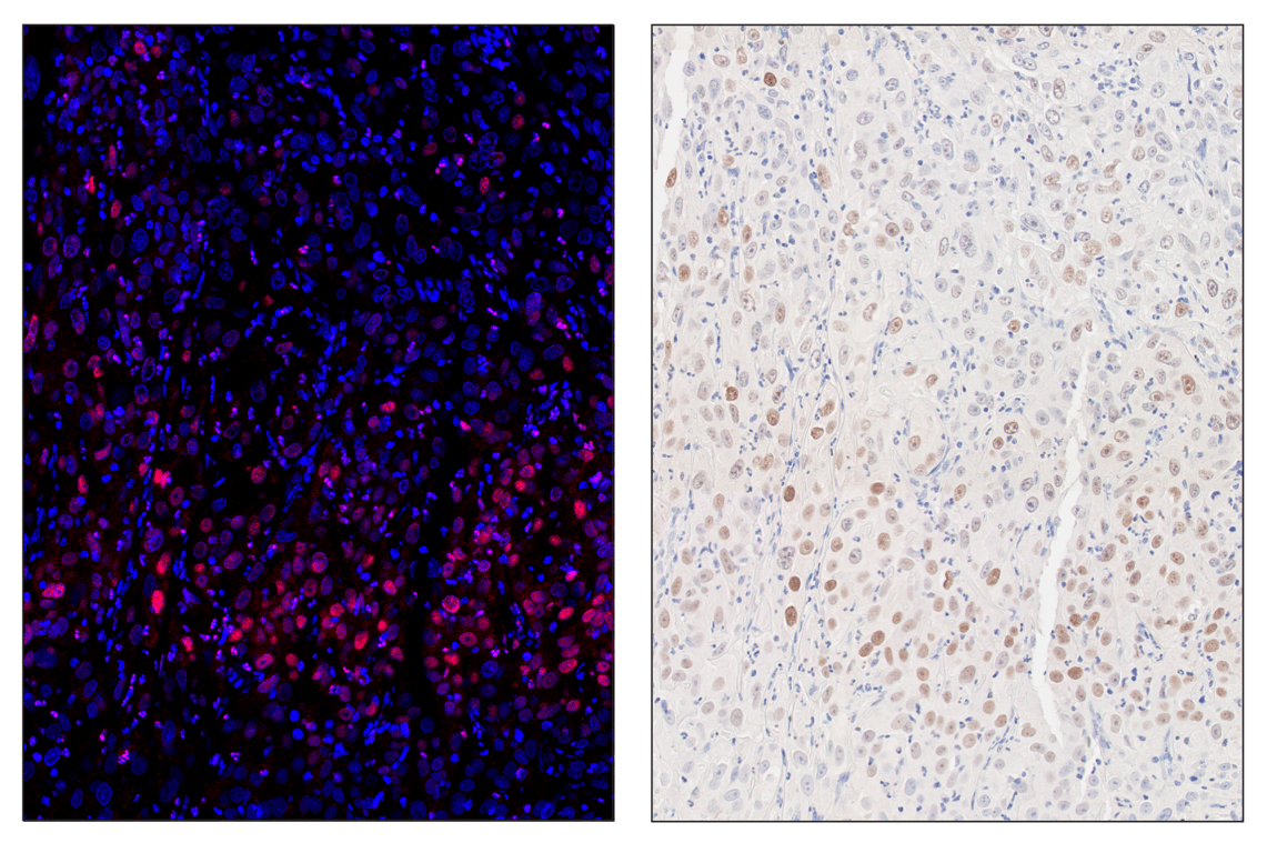 Immunohistochemistry Image 2: HIF-1 alpha (E1V6A) & CO-0117-488 SignalStar<sup>™</sup> Oligo-Antibody Pair