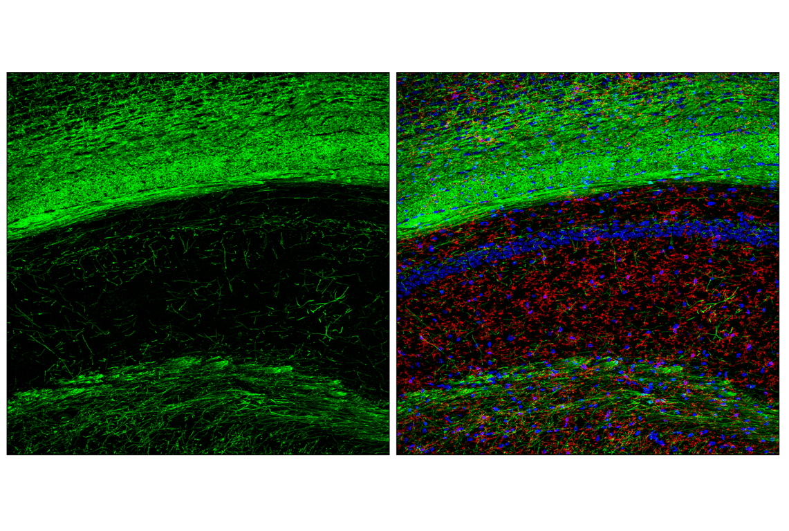 Immunofluorescence Image 2: CNPase (F6Y2X) Mouse Monoclonal Antibody