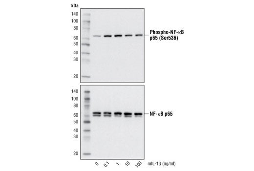 undefined Image 3: Mouse Interleukin-1β (mIL-1β)