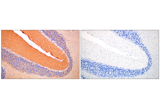 Immunohistochemistry Image 7: Ras (E8N8L) Rabbit Monoclonal Antibody (BSA and Azide Free)