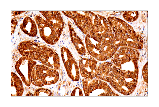 undefined Image 22: Ferroptosis Antibody Sampler Kit