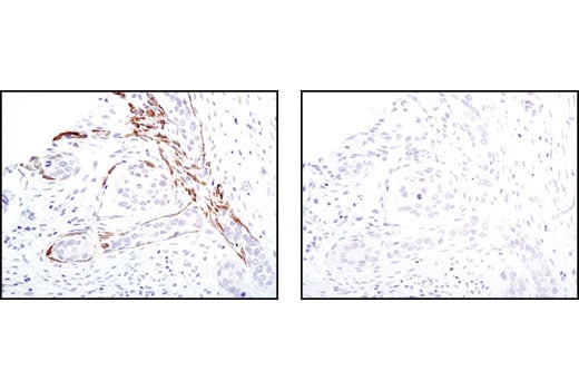 Immunohistochemistry Image 2: TrkA (14G6) Rabbit Monoclonal Antibody