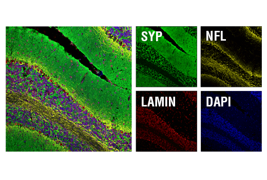 Immunofluorescence Image 2: Synaptophysin (D8F6H) Rabbit Monoclonal Antibody