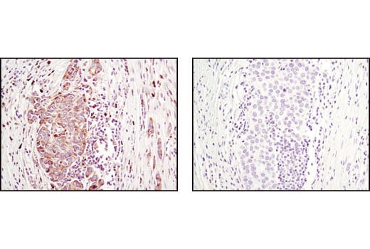 Immunohistochemistry Image 2: Asymmetric-Methyl-PABP1 (Arg455/Arg460) (C60A10) Rabbit Monoclonal Antibody