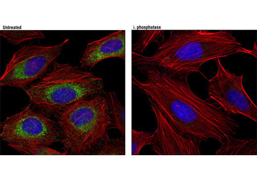 Immunofluorescence Image 1: Phospho-DRP1 (Ser616) (D9A1) Rabbit Monoclonal Antibody