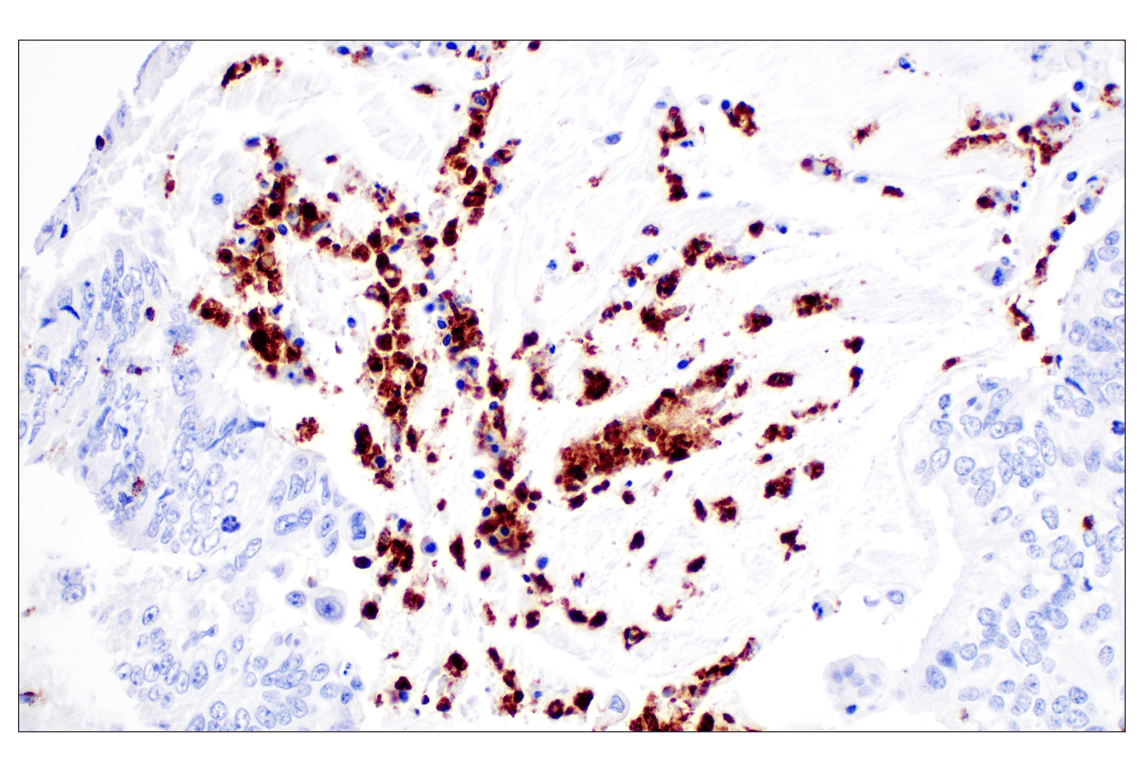 Immunohistochemistry Image 5: NKG7 (F4V5I) Rabbit Monoclonal Antibody (BSA and Azide Free)