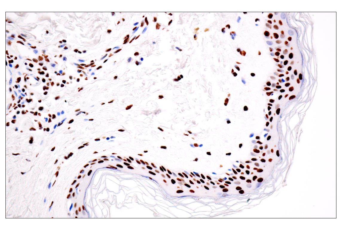 Immunohistochemistry Image 7: ILF3 (E5H6F) Rabbit Monoclonal Antibody