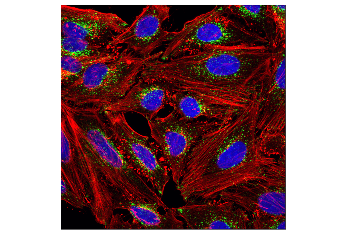 LAMP1 (D2D11) XP® Rabbit mAb (BSA and Azide Free) | Cell