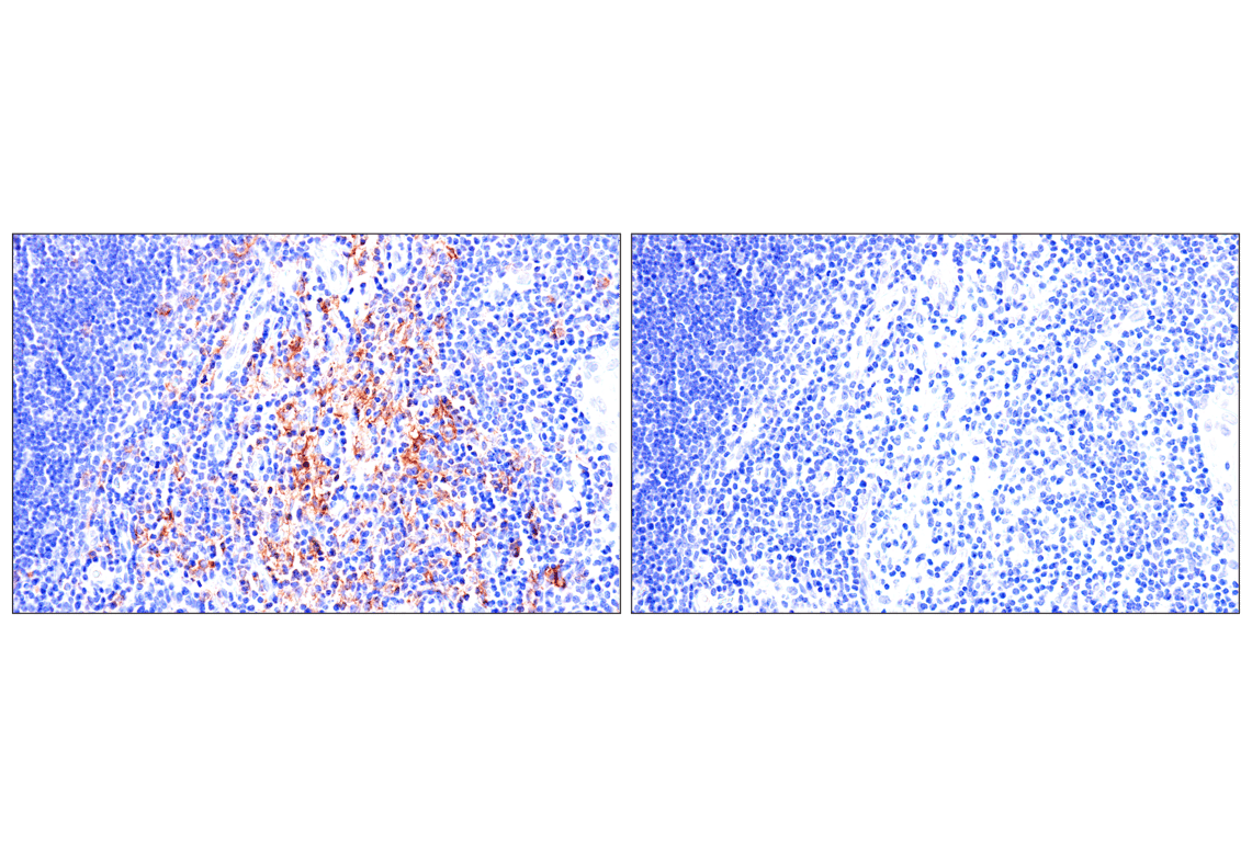 Immunohistochemistry Image 9: Semaphorin-4A (E5N3K) Rabbit Monoclonal Antibody (BSA and Azide Free)