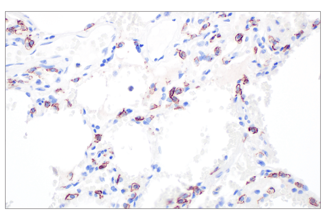 Immunohistochemistry Image 6: CD44 v6 (C44Mab-9) Mouse Monoclonal Antibody