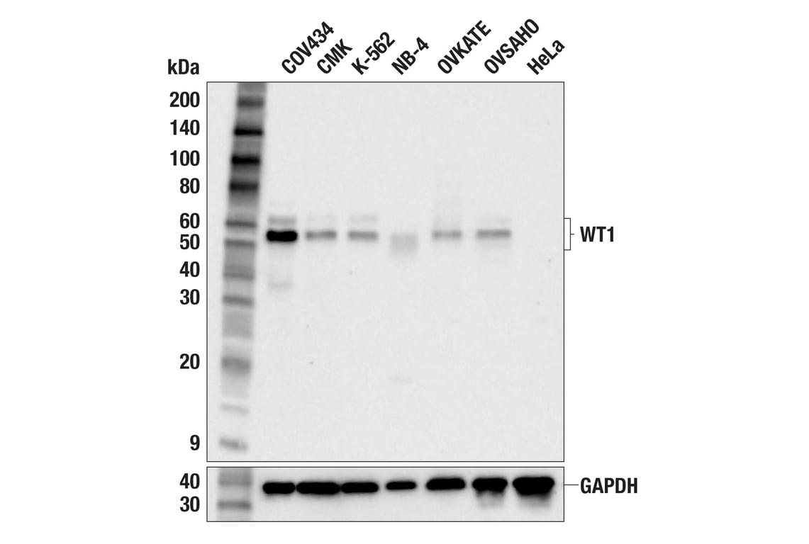 Western Blotting Image 2: WT1 (F3T7B) Rabbit Monoclonal Antibody (Carboxy-terminal Antigen)