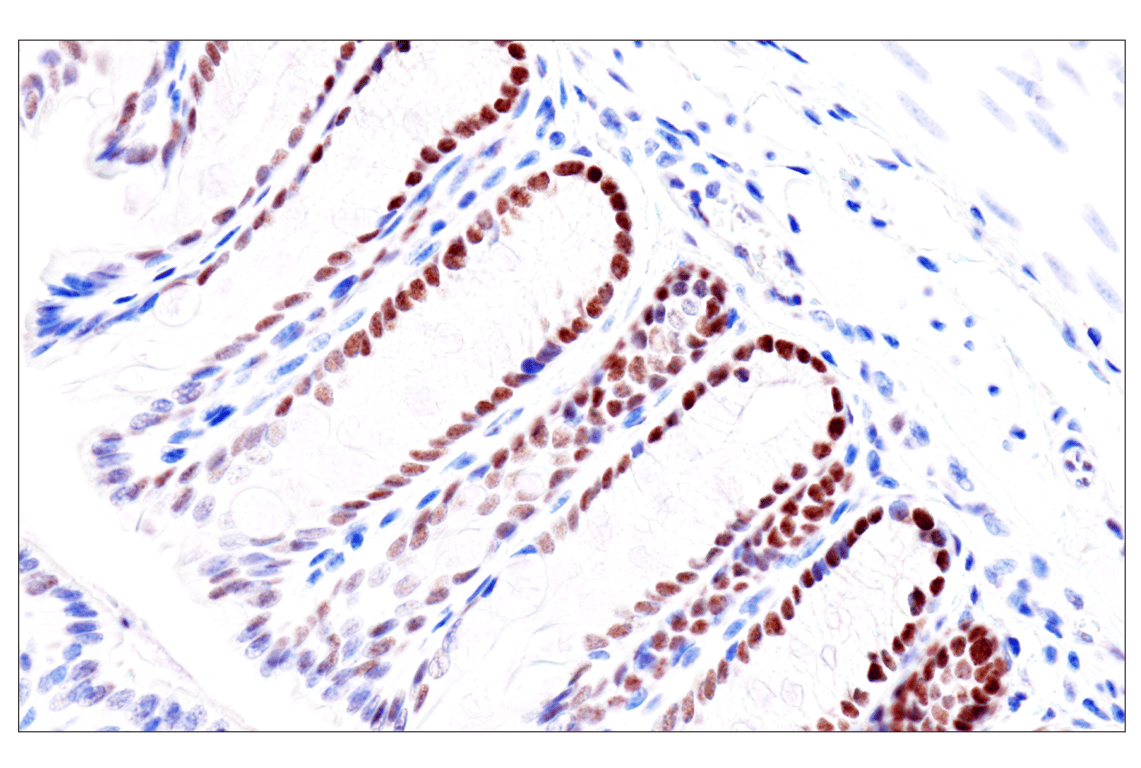 Immunohistochemistry Image 20: GATA-6 (D61E4) XP<sup>®</sup> Rabbit mAb