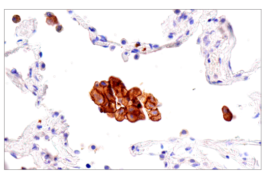 Immunohistochemistry Image 6: Transferrin Receptor/CD71 (10F11) Mouse Monoclonal Antibody