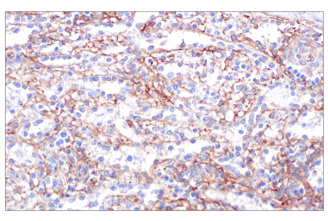 Immunohistochemistry Image 6: CD105/Endoglin (F9C5Q) Rabbit Monoclonal Antibody (BSA and Azide Free)
