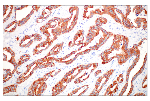 Immunohistochemistry Image 1: Pan-Keratin (C11) Mouse Monoclonal Antibody (BSA and Azide Free)