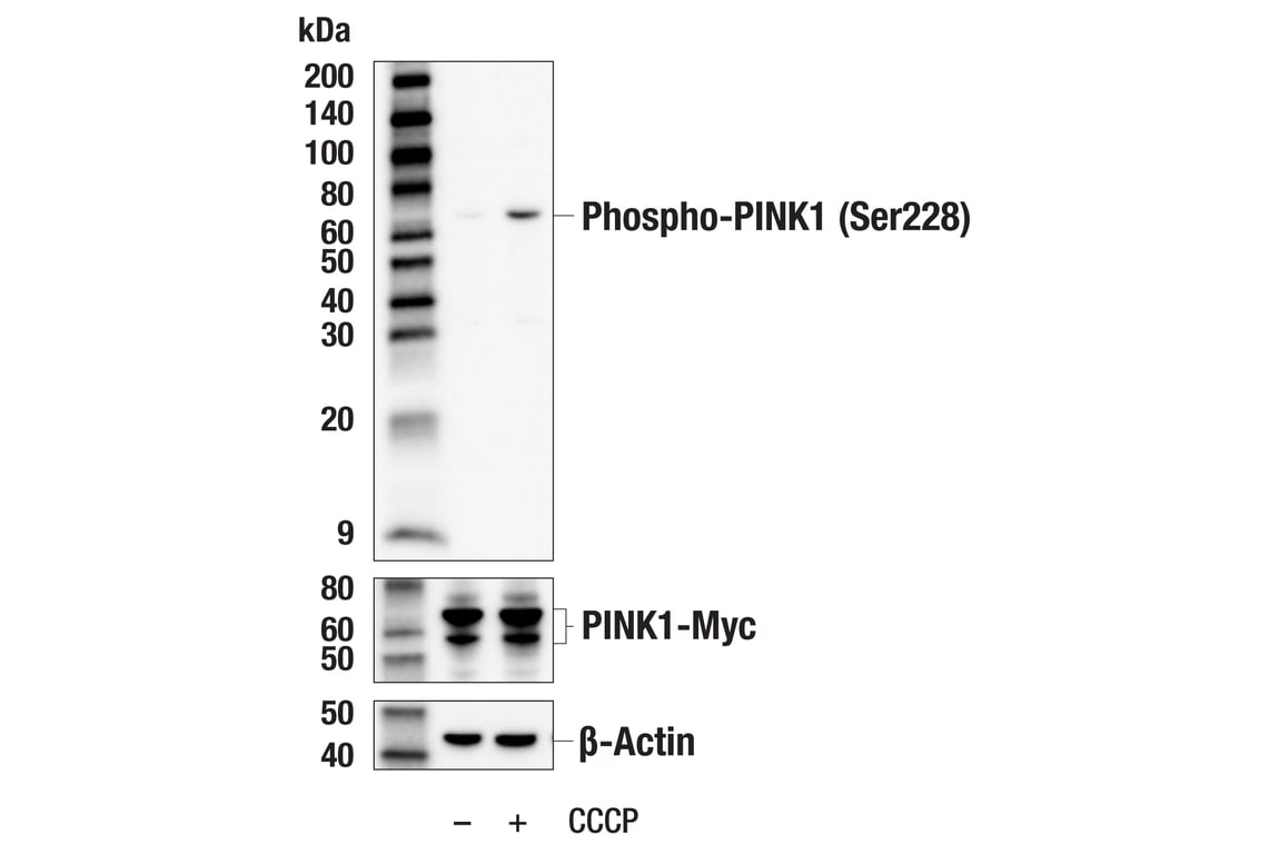 Western Blotting Image 1: Phospho-PINK1 (Ser228) (E9K3K) Rabbit mAb