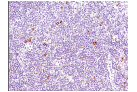 Immunohistochemistry Image 6: OX40 (E9U7O) XP<sup>®</sup> Rabbit mAb