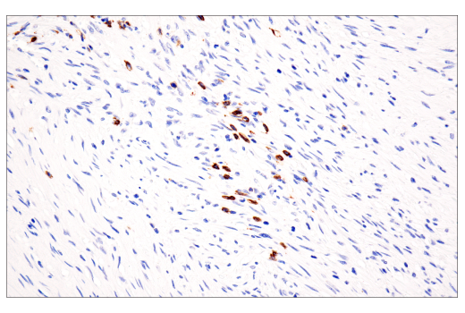 Immunohistochemistry Image 3: CD20 (E7B7T) Rabbit Monoclonal Antibody (BSA and Azide Free)