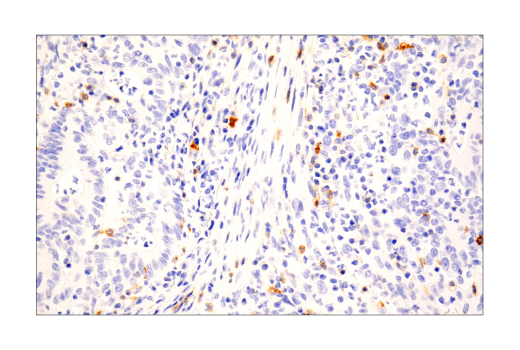 Immunohistochemistry Image 4: TNFRSF8/CD30 (E7E4D) Rabbit Monoclonal Antibody