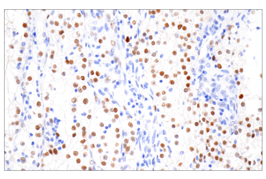 Immunohistochemistry Image 1: HIF-1 alpha (E1V6A) Rabbit Monoclonal Antibody