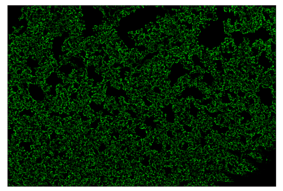 Immunohistochemistry Image 2: CD36 (E8B7S) & CO-0089-750 SignalStar<sup>™</sup> Oligo-Antibody Pair